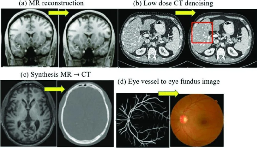 Utilizing Generative Adversarial Networks (GANs) for Creating Realistic Images through AI 9 Applications of GANs in Image Synthesis